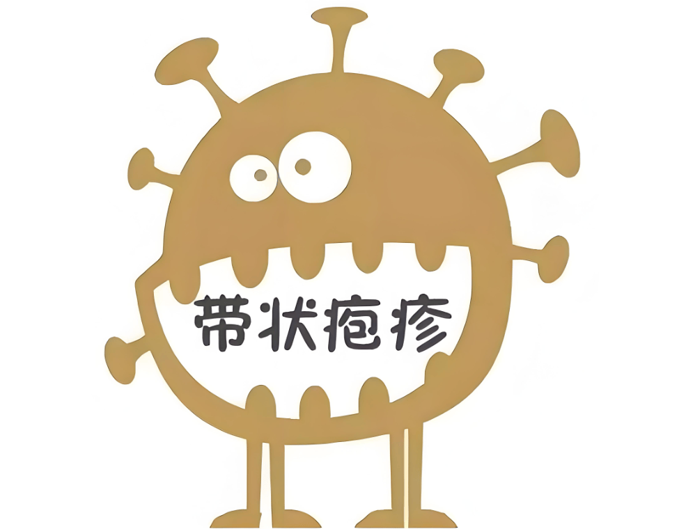 带状疱疹有哪些特点，它的成因有哪些?